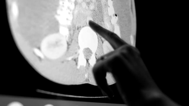 Video Reference: Flash photography, Gesture, Style, Black-and-white, Tints and shades, Monochrome photography, Circle, Monochrome, Wrist, Elbow