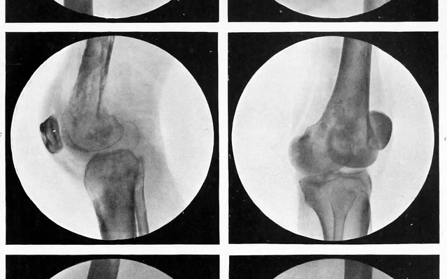 Video Reference: Jaw, Neck, Medical, Font, Radiology, Medical imaging, Service, Symmetry, Medical radiography, Monochrome