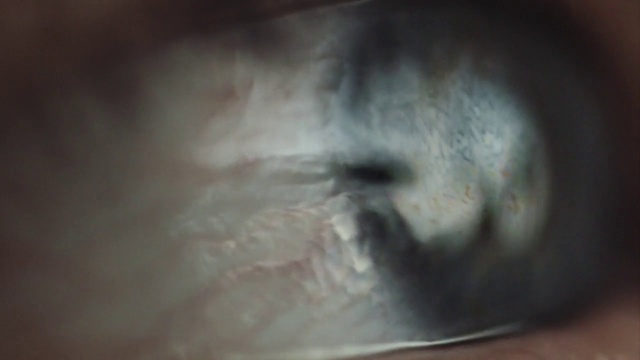 Video Reference: Leg, Human body, Eyelash, Wood, Tints and shades, Snout, Fur, Visual arts, Darkness, Circle