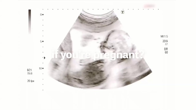 Video Reference: Product, Neck, Outerwear, Pattern, Fur, Fashion accessory, Metal