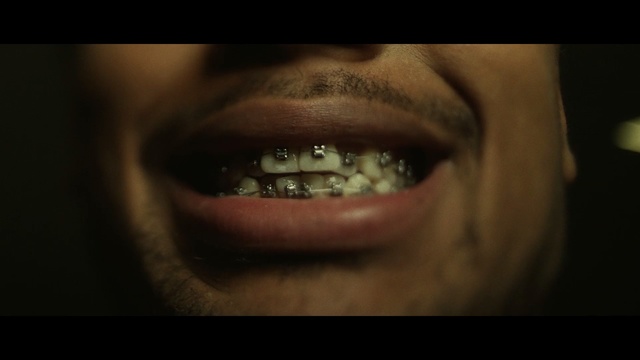 Video Reference: tooth, chin, jaw, lip, mouth, close up, cheek, darkness, smile, neck