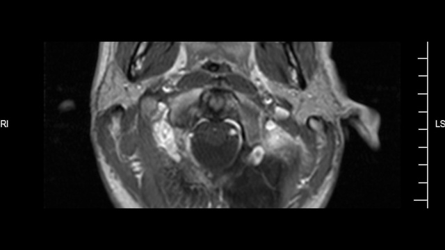 Video Reference: Medical imaging, Monochrome photography, Water, Still life photography, Radiology, Black-and-white, Jaw, Organism, Photography, Joint