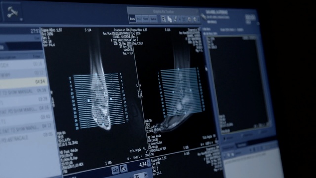 Video Reference: technology, software, electronics, computer hardware, product, multimedia, engineering, display device, screenshot, personal computer hardware