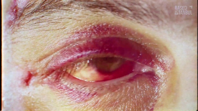 Video Reference: Hair, Nose, Head, Eye, Eyebrow, Eyelash, Organ, Human body, Iris, Ear