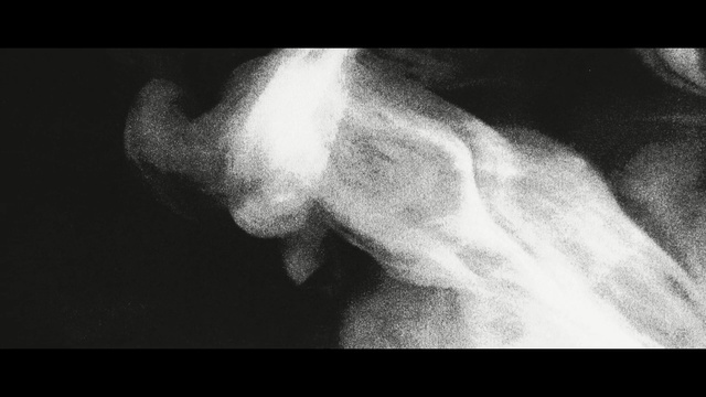 Video Reference: black, black and white, nose, monochrome photography, photography, close up, monochrome, darkness, atmosphere, medical radiography