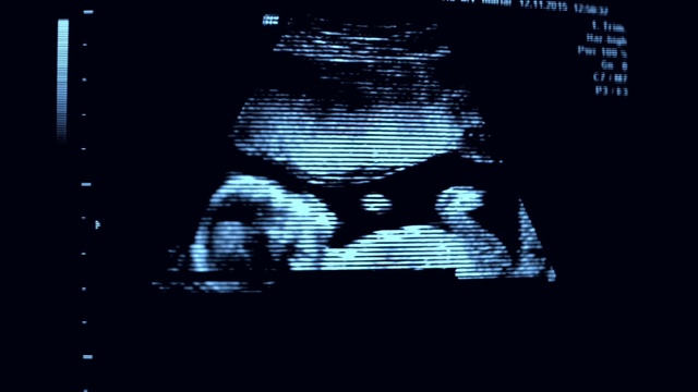 Video Reference: Medical imaging, Text, Font, Medical