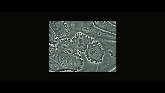 Video Reference: Organism, Font, Text, Pattern, Lace, Water, Design, Textile, Art, Visual arts