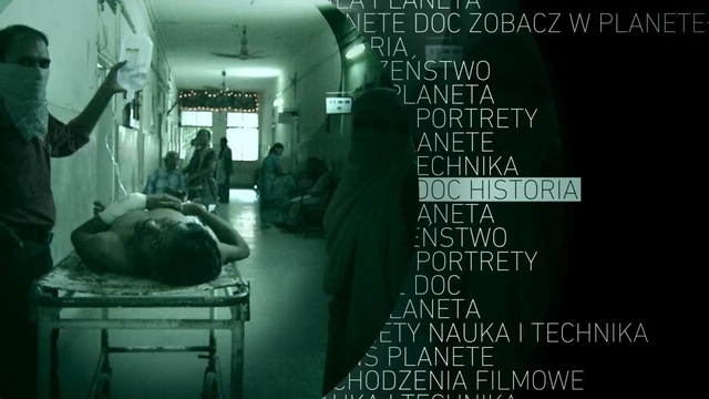 Video Reference: Snapshot, Organism, Photography, Room, Monochrome, Monochrome photography, Medical equipment, Black-and-white, Digital compositing, Movie