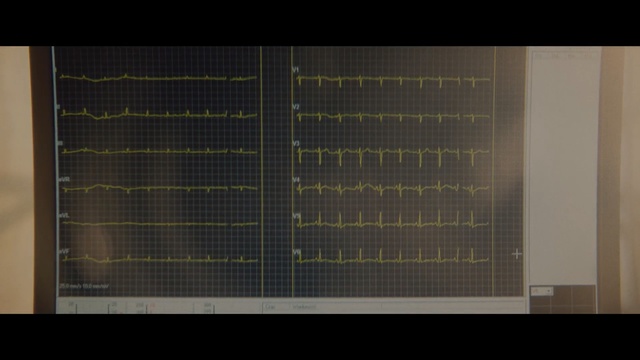 Video Reference: Line, Space, Tile