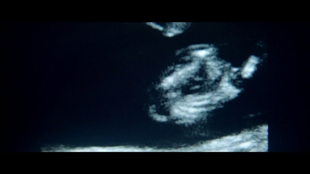 Video Reference: Black, Sky, Darkness, Atmosphere, Organism, Cloud, Photography, Night, Space, Earth