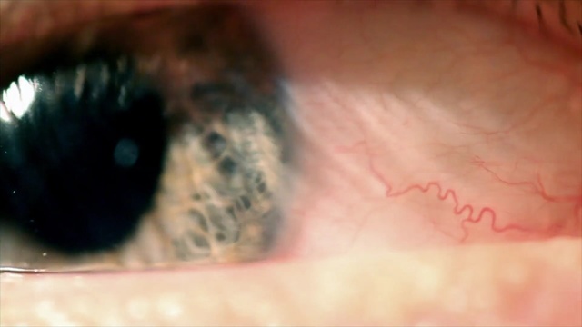 Video Reference: eye, skin, nose, close up, eyelash, lip, mouth, organ, iris, snout