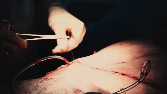 Video Reference: Nose, Hand, Flesh, Joint, Finger, Photography, Thumb