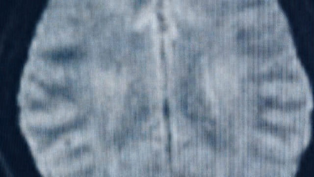 Video Reference: blue, white, denim, jeans, textile, sky, sleeve, pattern, Person