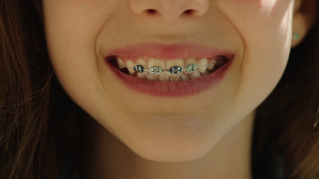 Video Reference: Tooth, Lip, Face, Jaw, Mouth, Smile, Dental braces, Facial expression, Chin, Skin, Person, Woman, Indoor, Teeth, Brushing, Girl, Toothbrush, Beautiful, Young, Looking, Brush, Close, Wearing, Hair, Camera, Lady, Shirt, Smiling, Eyes, Little, Posing, Red, Black, Female, Sunglasses, Glasses, Holding, Eating, Pink, Food, White, Blue, Lipstick, Cosmetics, Eyelash, Organ, Eyebrow, Close-up, Human face, Mascara, Cheek, Iris, Lip gloss, Eye shadow, Tongue, Nose, Eye liner, Cosmetic, Brace, Cosmetic dentistry, Eyelash extensions, Selfie, Pretty, Spectacles, Staring