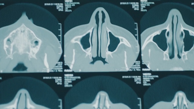 Video Reference: Medical imaging, Computed tomography, Text, Medical, Organ, X-ray, Joint, Radiology, Font, Human body