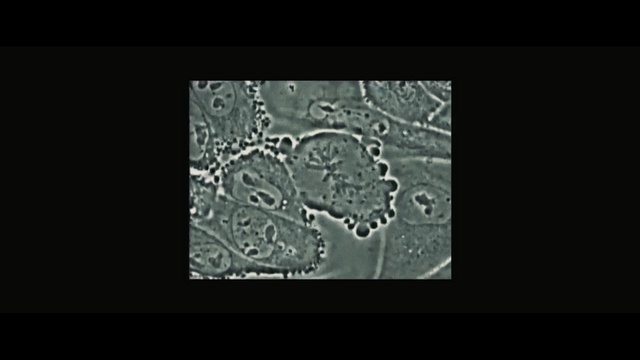 Video Reference: Organism, Font, Text, Pattern, Leaf, Monochrome photography, Water, Black-and-white, Textile, Lace