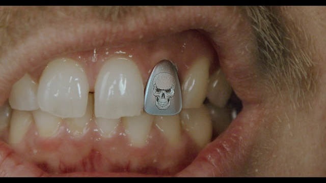 Video Reference: Tooth, Jaw, Organ, Mouth, Close-up, Skin, Human body, Dentistry, Nail, Iris