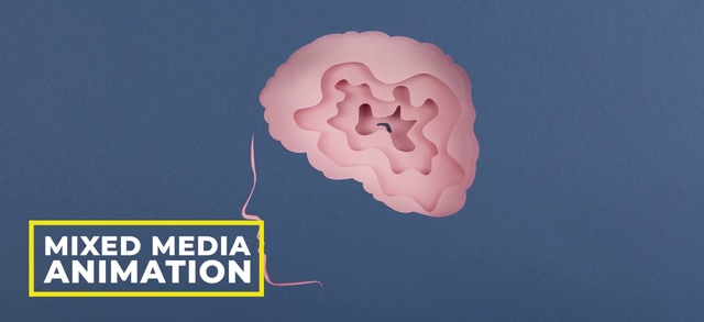 Video Reference: Brain, Brain, Organ, Organism, Human body, Cloud, Animation