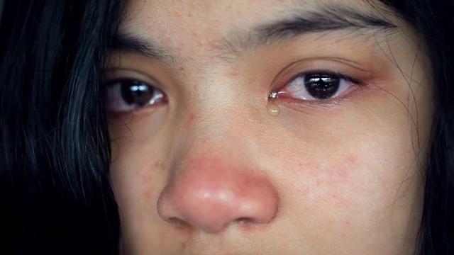 Video Reference: Face, Eyebrow, Nose, Cheek, Forehead, Hair, Skin, Lip, Close-up, Eyelash