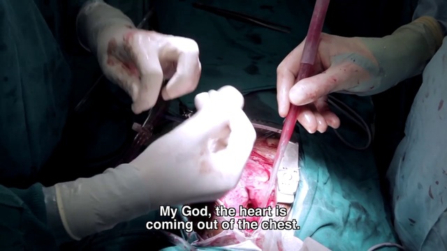 Video Reference: Hand, Finger, Skin, Joint, Nail, Mouth, Thumb, Muscle, Medical, Flesh