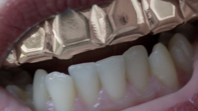 Video Reference: Tooth, Organ, Mouth, Jaw, Human body, Cosmetic dentistry, Dentistry, Nail, Person