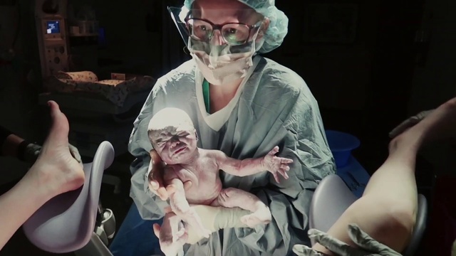 Video Reference: Human, Human body, Fictional character, Flesh, Jaw, Childbirth, Surgeon, Zombie