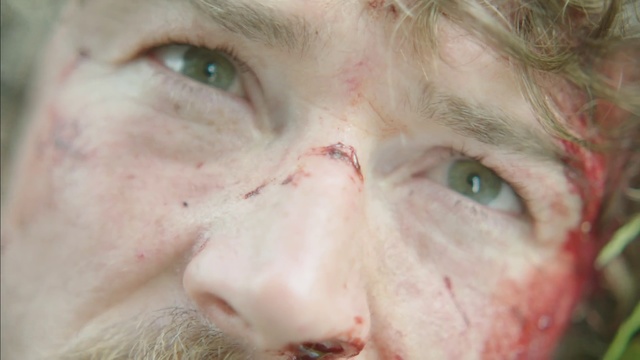 Video Reference: Face, Skin, Nose, Close-up, Head, Cheek, Eye, Lip, Snout, Forehead, Person