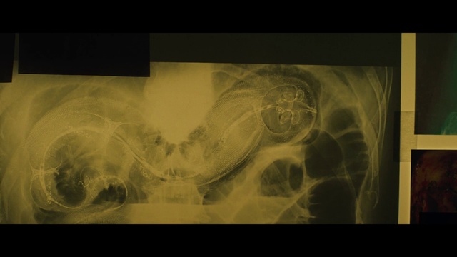 Video Reference: Art, Radiography, Organism, Radiology, Stock photography, Font, Visual arts, Photography