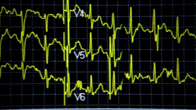 Video Reference: Text, Font, Oscilloscope, Green, Line, Pattern, Design, Number, Parallel, Graphics