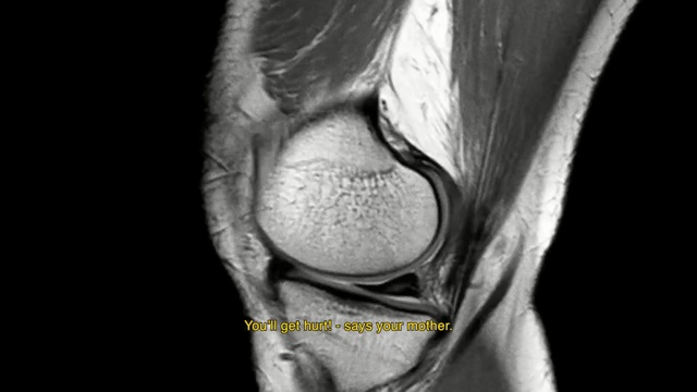 Video Reference: Shoulder, Joint, Knee, Arm, Medical imaging, Elbow, Organ, Close-up, Still life photography, Human body