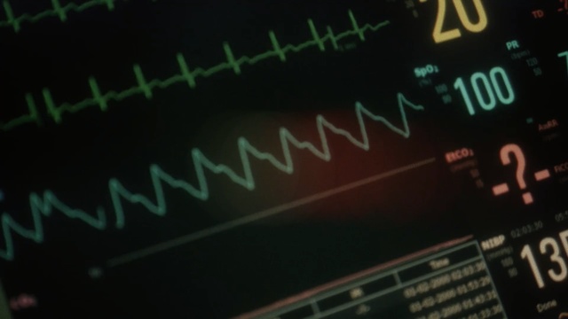 Video Reference: Electronics, Speedometer, Text, Font, Odometer, Auto part, Technology, Display device, Electronic device