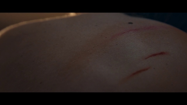 Video Reference: Skin, Eyebrow, Nose, Close-up, Scar, Flesh, Eye, Atmosphere, Hand, Mouth