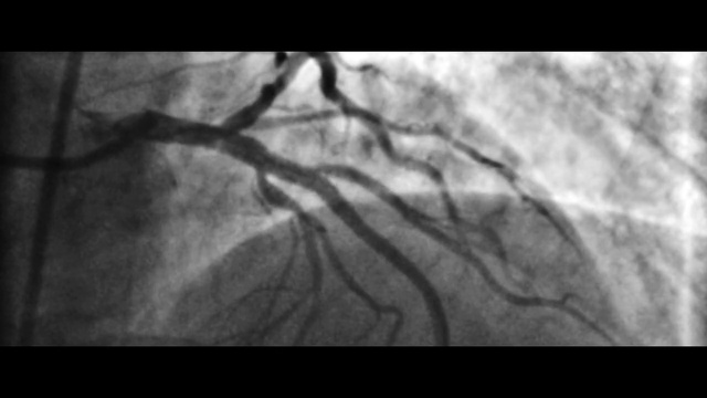 Video Reference: Monochrome photography, Black-and-white, Photograph, Nature, Monochrome, Branch, Tree, Still life photography, Organism, Wildlife