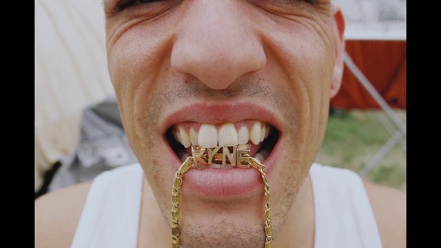 Video Reference: Tooth, Facial expression, Mouth, Nose, Jaw, Organ, Chin, Close-up, Tongue, Smile