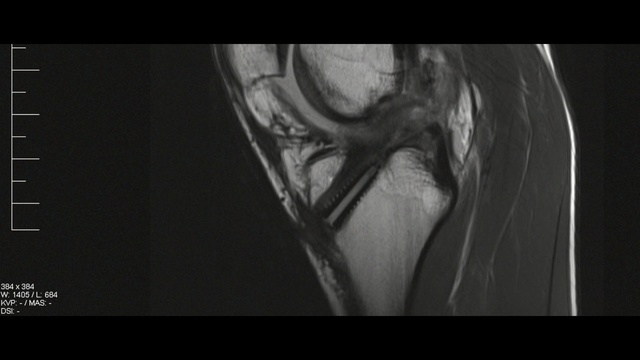 Video Reference: medical imaging, black, medical radiography, x ray, black and white, radiography, radiology, joint, medical, jaw