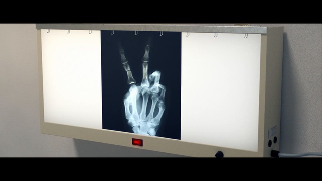 Video Reference: White, X-ray, Projection screen, Technology, Art, Electronic device, Display device, Radiography, Visual arts, Media