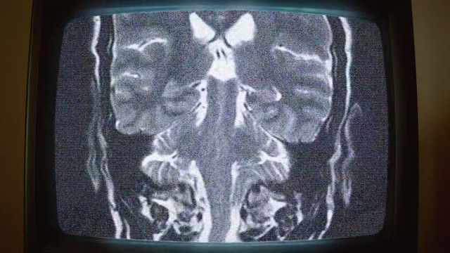 Video Reference: medical imaging, x ray, medical, pattern, radiology, Person