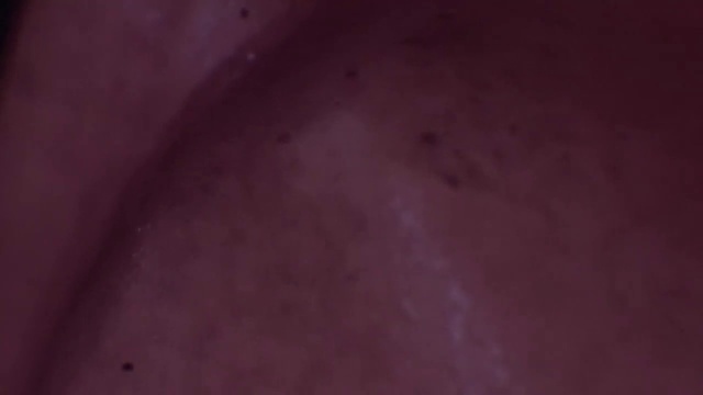 Video Reference: Skin, Red, Pink, Maroon, Neck, Nose, Chin, Flesh, Mouth, Muscle