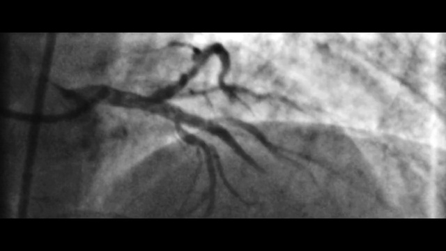 Video Reference: Monochrome photography, Black-and-white, Photograph, Nature, Black, Monochrome, Still life photography, Wildlife, Photography, Branch