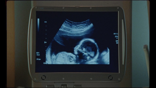 Video Reference: Screen, Display device, Medical, Gadget, Electronic device, Medical equipment, Technology, Multimedia, Media, Electronics, Monitor, Indoor, Television, Sitting, Computer, Photo, Table, Front, Black, Small, Set, Desk, Keyboard, Cat, Laptop, Old, Desktop, Video, Display, Large, Man, White, Standing, Screenshot, Text, Medical imaging, Computer monitor, Radiology, Medical radiography, Obstetric ultrasonography, Output device, Flat panel display, Radiography, Tablet computer, Multimedia software, X-ray, Image