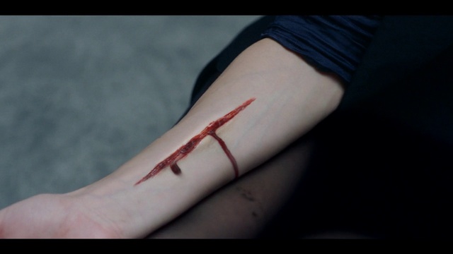 Video Reference: Skin, Arm, Hand, Finger, Joint, Human leg, Scar, Flesh, Wrist, Leg