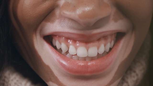 Video Reference: face, lip, tooth, facial expression, smile, cheek, nose, chin, close up, mouth, Person