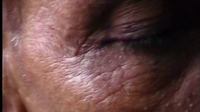 Video Reference: Hair, Skin, Close-up, Forehead, Flesh, Nose, Wrinkle, Muscle, Eyelash, Facial hair