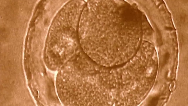 Video Reference: Eye, Circle