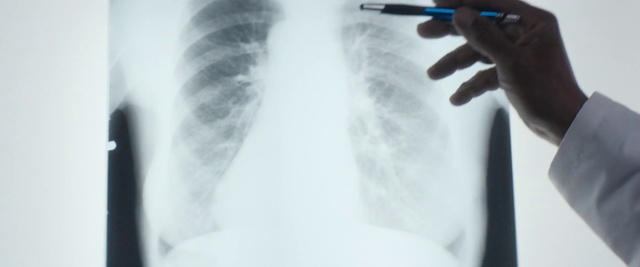 Video Reference: X-ray, Radiography, Radiology, Joint, Medical, Shoulder, Service, Medical radiography, Hand, Neck