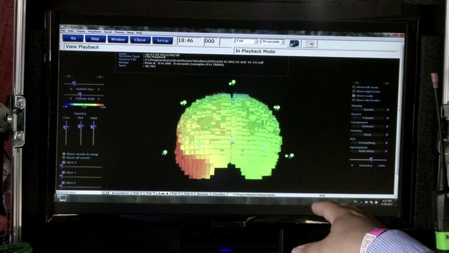 Video Reference: Screen, Display device, Electronics, Technology, Computer monitor, Multimedia, Electronic device, Computer program, Media, Brain