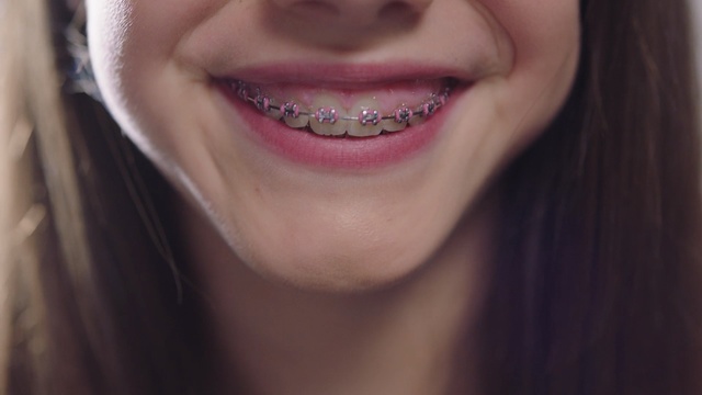 Video Reference: lip, smile, chin, tooth, cheek, close up, jaw, mouth, girl, dentistry