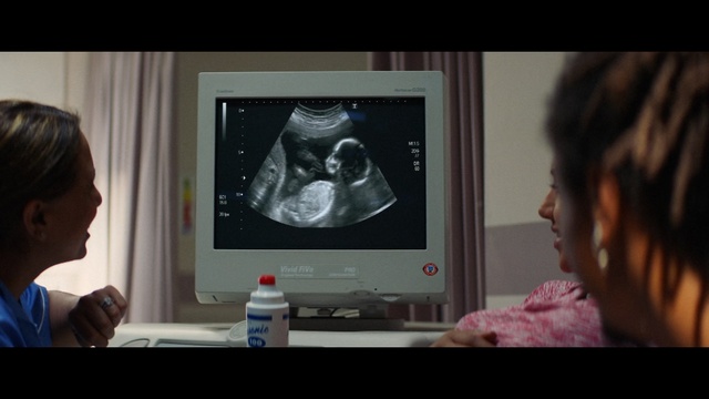 Video Reference: Medical, Medical equipment, Media, Jaw, Medical imaging, Radiology, Service, Technology, Electronic device, Screenshot