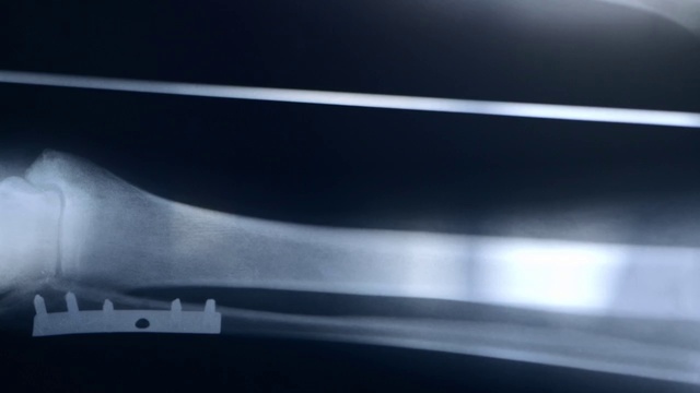 Video Reference: Joint, Automotive exterior, Vehicle door, Bumper