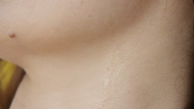 Video Reference: skin, chin, cheek, neck, close up, forehead, chest, lip, joint, abdomen